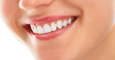 best natural teeth whitening