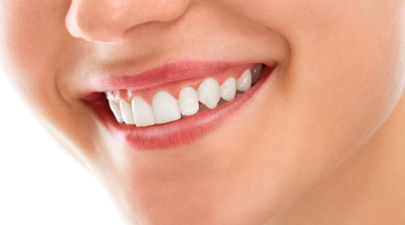 best natural teeth whitening